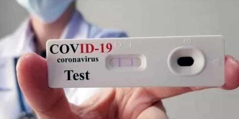 Test antigenico rapido Covid - 19