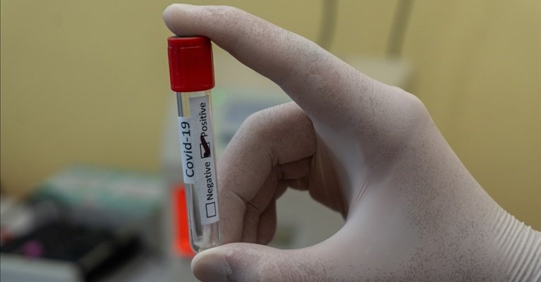 scendono i contagi in Toscana