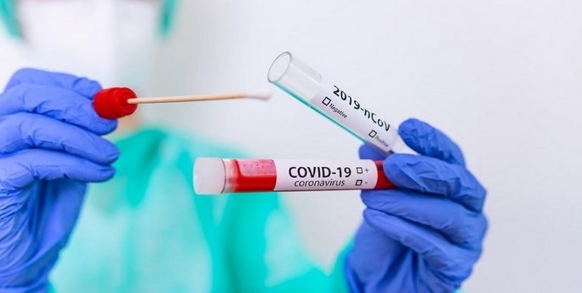 Tampone Covid