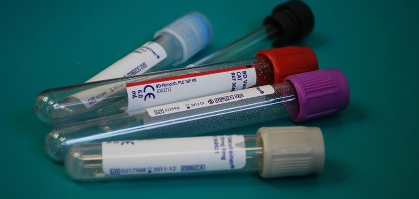 Prelievi sangue