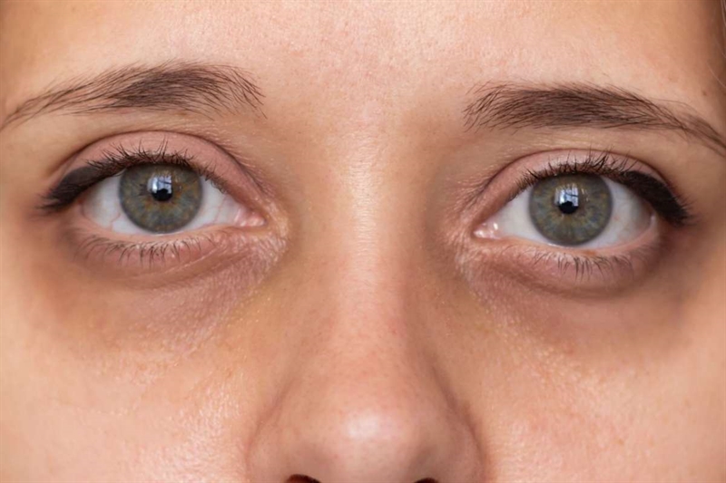 786d84 occhiaie 23092025 www okmugello it